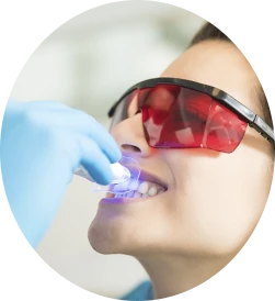 Clareamento Dentário